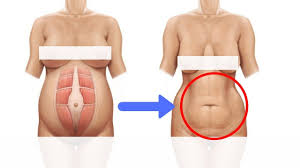 Pin On Exercise
