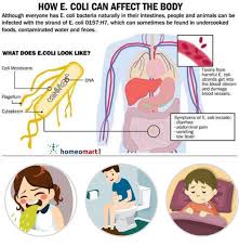Ecoli Bacteria Infection Symptoms And Remedies Bacterial Infection Infections Homeopathy