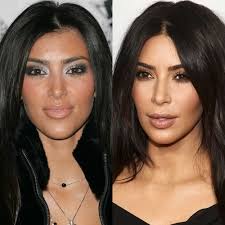 Para nadie es un secreto que en el mundo actual donde vivimos, los hombres que se dedican al mundo del cine y el espectáculo ya no sólo deben preocuparse por su condición física o por su capacidad para actuar. Bichectomia Kim Kardashian Antes Despues Clinicas Massana