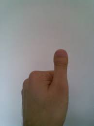 The mother had short stubby thumbs and the daughter had posteriorly angulated ears and delayed bone age. About The World Of Clubbed Thumbs World Of Clubbed Thumbs