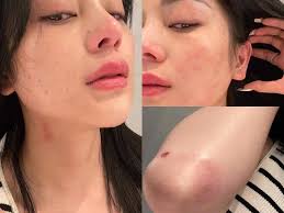 Ngọc nữ Bolero” lại gặp vận đen sau khi bị đánh bầm dập