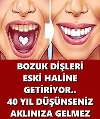 Pin By Gonul Dingis On Faydali Bilgiler Infographic Health Natural Health Remedies Dental Health