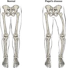 Image result for Orthopichonia