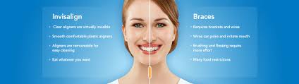 Remember, while the cost of braces may seem daunting, a healthy smile can make a huge difference in confidence for both kids and adults. Invisalign Vs Braces The Top 10 Differences