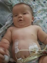 Baby experiences nausea and fever