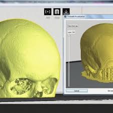 Invesalius is internationalized (currently available in english. Skull Stripping In Invesalius Medical Image Program Download Scientific Diagram