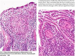 We did not find results for: Tuberculoid Granulomatous Inflammation In The Terminal Ileum Of A Cow Download Scientific Diagram