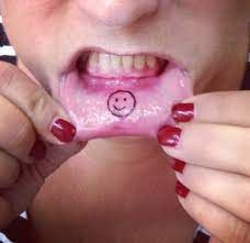 If you smoke, you are far more likely to experience oral cancer than someone who does not. What Are The Risks Of Mouth Piercings And Tattoos