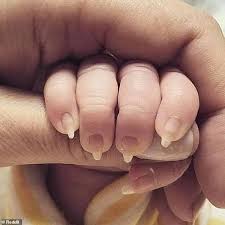 Our subreddit is primarily for discussions and memes that an average teenager would enjoy to discuss about. Reddit Mage Of A Baby S Nails That Could Tear Your Face Right Up Goes Viral Trends Wide