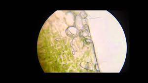 The pressure exerted by the contents of a plant cell against the cell wall when water enters the central vacuole and surrounding cytoplasm (occurs when a plant cell is placed in a hypotonic solution). Plant Cells In Hypertonic Solution Of Kno3 Potassium Nitrate Under Microscope Youtube