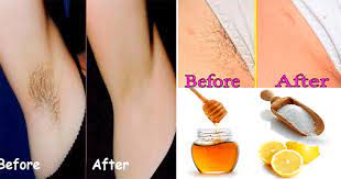 The only precaution you should take is never to apply any such creams on any of your mucus membranes like. Best Way To Remove Pubic Hair Permanently With Sugar Honey And Lemon