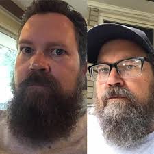 Work the dye deeply into your beard to ensure that you cover all visible patches. Should I Dye My Beard Groenerekenkamer