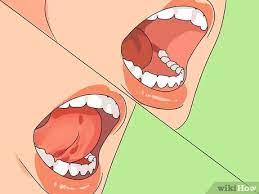 Morgano points out that most people do this by accident, if they do it at all. How To Gleek Wikihow