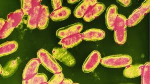 Whooping cough caused thousands of deaths in the 1930s and 1940s. Catch Whooping Cough And Get 3 500 Bbc News