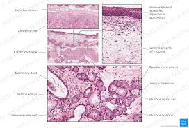 The maxillary sinuses are the biggest sinuses and rest in any of these cells can give rise to cancer, which explains why both nasal and paranasal cancers can potentially have varied histology, or cellular. Upper Respiratory Tract Histology And Pathology Kenhub