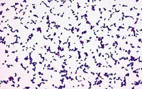 Bureau of microbial hazards, food directorate, health protection branch, health and has demonstrated that gram staining of the gastric aspirate may be a reliable test for early diagnosis of listerial infection (49). Listeria Ivanovii