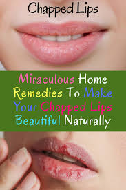 Miraculous Home Remedies To Make Your Chapped Lips Beautiful Naturally Glow Hakcs Dry Lips Remedy Cure For Chapped Lips Chapped Lips