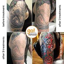 If you don't want to take your tattoos. Tattoo Removal To Tattoo Cover Up Go Tattoo Removal