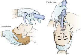 Laryngoscope Blade An Overview Sciencedirect Topics