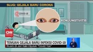 Dimana sebanyak 7 di antaranya terbilang gejala baru. Temuan Gejala Baru Infeksi Covid 19 Youtube