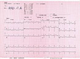 Maybe you would like to learn more about one of these? Electrocardiography Wikiwand