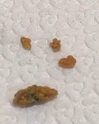 Lobak putih dapat dikonsumsi secara langsung dengan diolah menjadi salad ataupun jus, selain itu dapat diolah dengan cara dimasak terlebih dahulu cara membuat ramuan ini sangatlah mudah yaitu dengan membuat jus dengan kombinasi 250g lobak, 1 buah nanas utuh, dan 3 buah kemiri. Cara Rawat Batu Karang Secara Semula Jadi Guna Tiga Bahan Sahaja Lelaki Ini Kongsikan Petuanya Dengan Jus Lobak Putih Keluarga