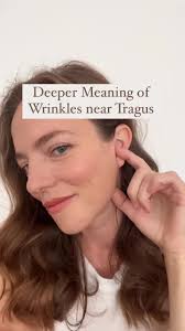 Mole in Front of Ear Meaning