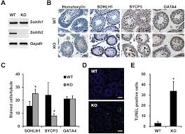 Sperm Biology From Production To Ejaculation | Abdominal Key