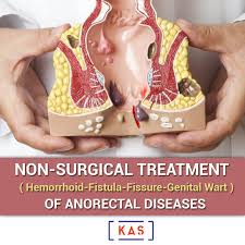 This is a situation where a hair on the human body curls or grows completely under your skin. Anal Fissure Istanbul Ozel Kas Tip Merkezi
