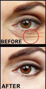 Magic Eye Cream Remove Eye Bags Dark Circles Eye Wrinkles Order Now Remove Eye Wrinkles Under Eye Wrinkles Eye Wrinkle