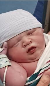 Elliot Grace was born with a rare medical condition. Her life is just as  valuable as any other baby. t.co/Mw8c3EBSdb