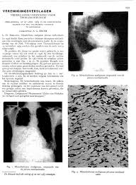 Bekendstelling toespraak voorbeelde * mesothelioma is a form positive change with some in the mesothelial cells lack of blood from. 2