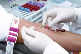 Il rischio di sviluppare una leucemia aumenta con: Leucemia Acuta Mieloida Lma Ghid Cancer Ro