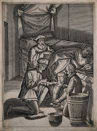 Bloodletting and Pleurisy – Early Modern Medicine