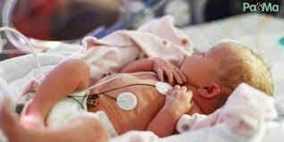 Halo, pramatang adalah buruh yang berlaku semasa kehamilan adalah <37 minggu. Jangan Samakan Bayi Pramatang Dengan Baby Cukup Bulan Proses Tumbesarannya Berbeza Pa Ma