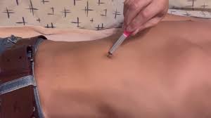 Navel ... penetration - ThisVid.com
