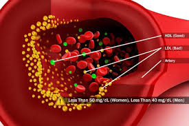 Cholesterol and metabolic disorders