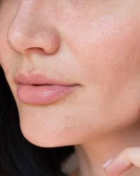 Dull, Dry & Dehydrated Skin