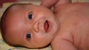 Læge: Vælg dit barns øjenfarve