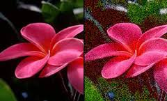 Visual snow is a very rare neurological condition that causes the sufferer to see a field of grain and dots over their vision at all times. Visual Snow Hyponatremia And Central Pontine Myelinolysis