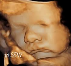 Diese verbietet ab dem 1. Babykino 3d Das Original Seit 2012 Liebe Fans Des Babykinos Viele Haben Sicher Schon Gehort Dass Ab 2021 Ultraschall Am Foten Aus Nicht Medizinischen Grunden Verboten Werden Soll Das Ware