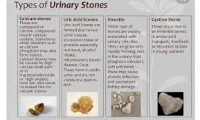 Il faut noter cependant que la majorité des patients montrant des cristaux d'oxalate de calcium ne formeront jamais de calculs. Uro Nephrologie Semiologie Chap 4 Medecine Integree