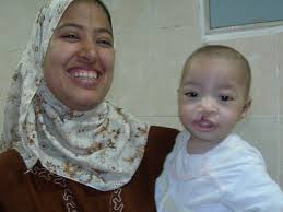 Rotaplast Missions: 2010 Sohag, Egypt