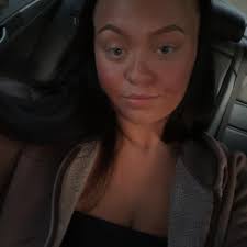 How to get rid of pregnancy acne?