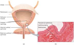 Urinary Incontinence - Stress - Urge - Management - TeachMeObGyn