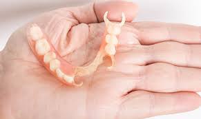Traditional removable full dentures are held in place on the roof of your mouth by suction. Choose The Right Patients For Flexible Removable Partial Dentures
