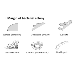 Colony Morphology Of Various Bacteria Laboratoryinfo Com