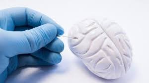 Parkinson Un Medicament Injectable Donne Des Resultats Prometteurs Stroke Recovery Disease Survivor