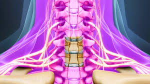 Acdf Surgery Postoperative Care Acdf Surgery Spinal Fusion Surgery Spinal Fusion