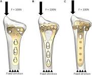 Frontiers | Evaluating the biomechanical performance of ...